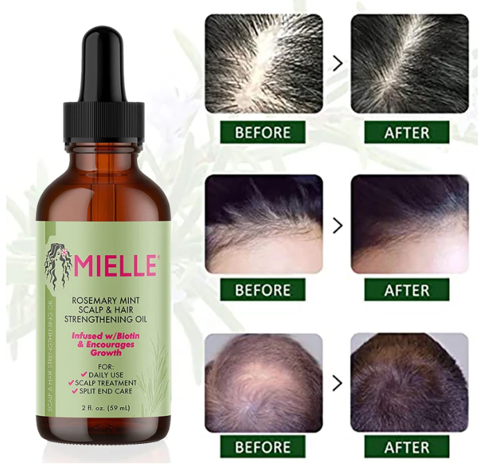 Scalp & Hair Strengthening Oil